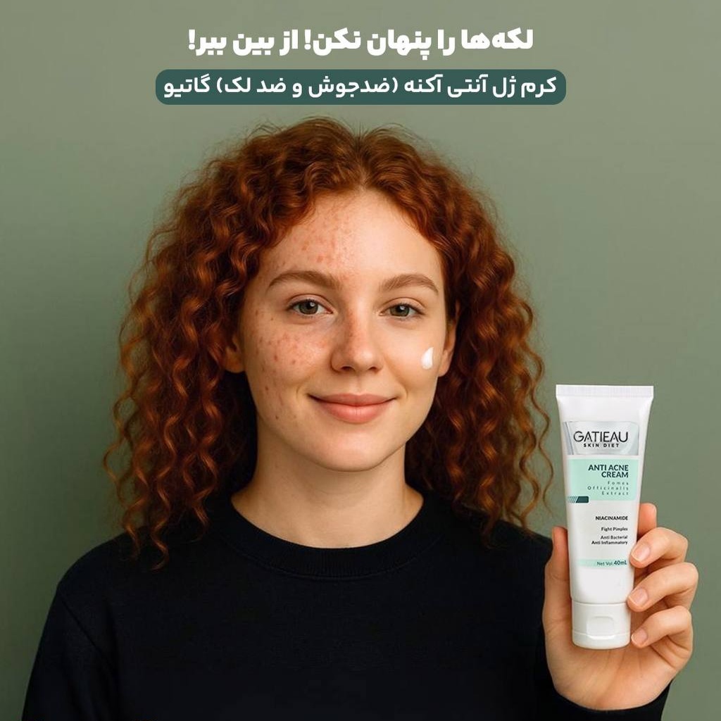 کرم ژل آنتی آکنه گاتیو